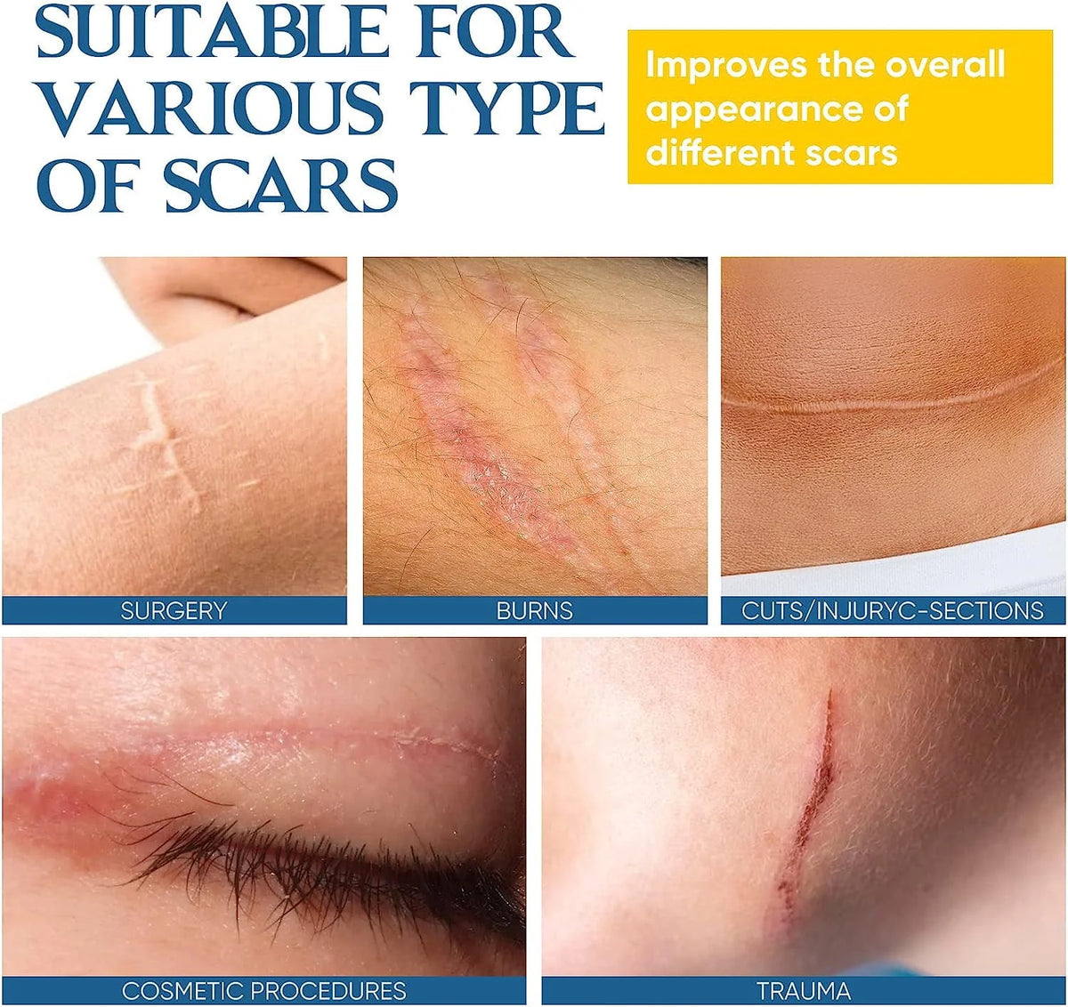 Scar Cream Gel with Allantoin and Retinol F91140